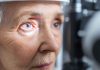 Fundación Arturo López Pérez y Clínica Oftalmológica Pasteur impulsan modelo integrado para el tratamiento del cáncer ocular y otras derivadas