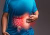 Cáncer colorrectal al alza en Chile: el test FIT ayuda a detectarlo a tiempo y los estudios genéticos a tratarlo mejor Cáncer colorrectal al alza en Chile: el test FIT ayuda a detectarlo a tiempo y los estudios genéticos a tratarlo mejor