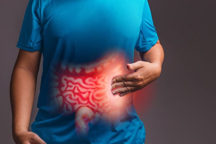 Cáncer colorrectal al alza en Chile el test FIT ayuda a detectarlo a tiempo y los estudios genéticos a tratarlo mejor Cáncer colorrectal al alza en Chile: el test FIT ayuda a detectarlo a tiempo y los estudios genéticos a tratarlo mejor